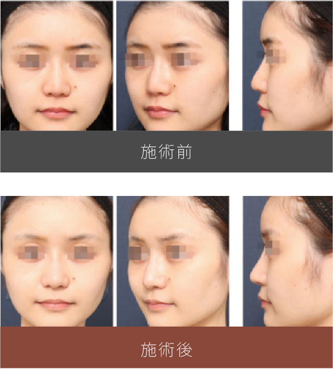 施術前後の比較