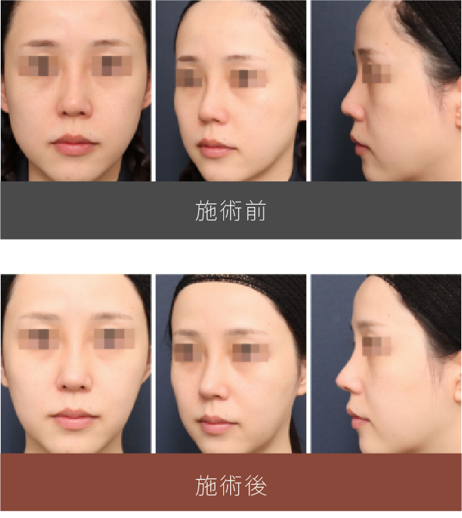 施術前後の比較