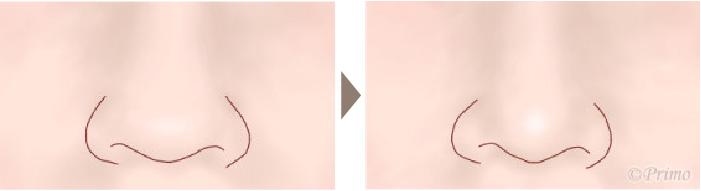 施術前後イメージ