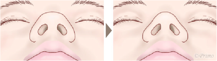 施術前後イメージ