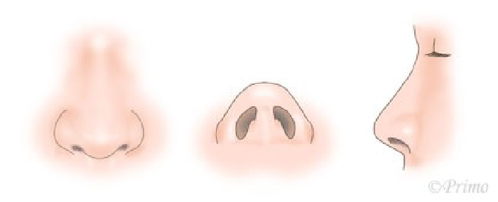 鼻尖縮小術の注意点