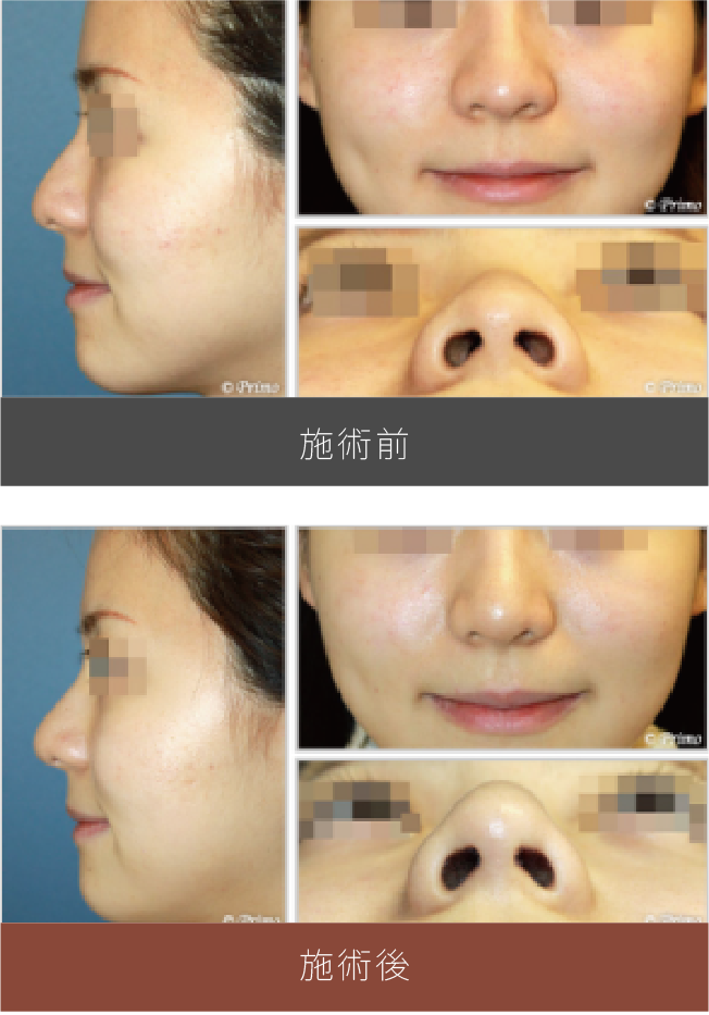 施術前後の比較