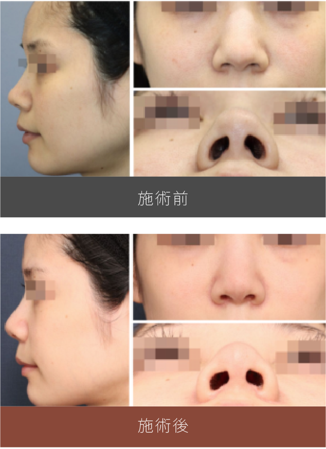 施術前後の比較