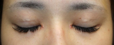 20170202po3W目元閉眼