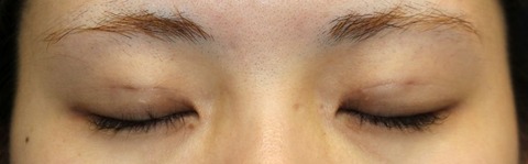 20161222po2W目元閉眼