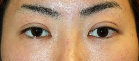 20161026po2M目もと