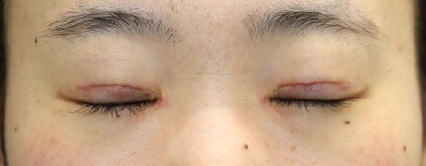 2010401po1M目元閉眼