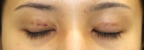 20170608po1W目元閉眼