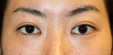 20170204po6M目もと