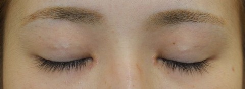 20170411po2m IMG_8449