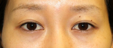 20160929po6M目もと