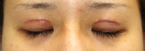 20170208po1W目元閉眼