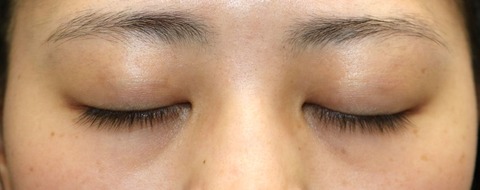 20170410po3M目元閉眼