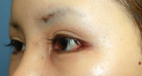 20160902po1W左斜め