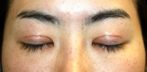 20160917po2W目もと閉瞼