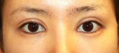 20160829po1M目もと