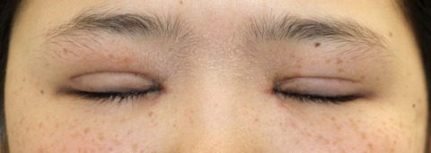 20170123po1M目元閉眼