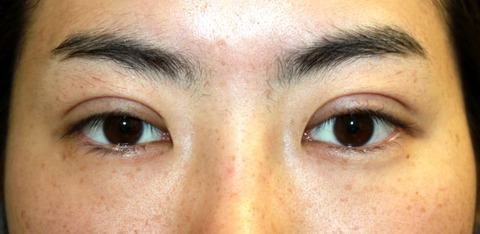 20160917po2W目もと