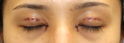 20170529po1d目元閉眼