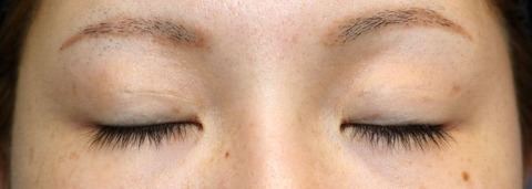 20161013po3M目元閉瞼