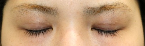 20170506po2W目元閉眼