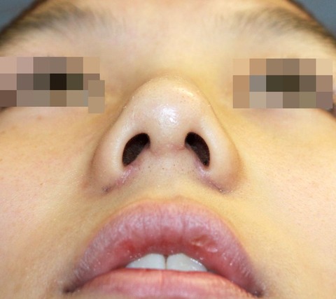 20160921po2Wあおり