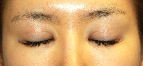 20160829po3M目もと閉瞼