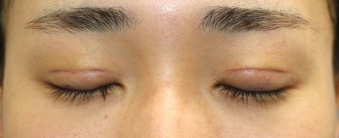 20170410po1W目元閉眼