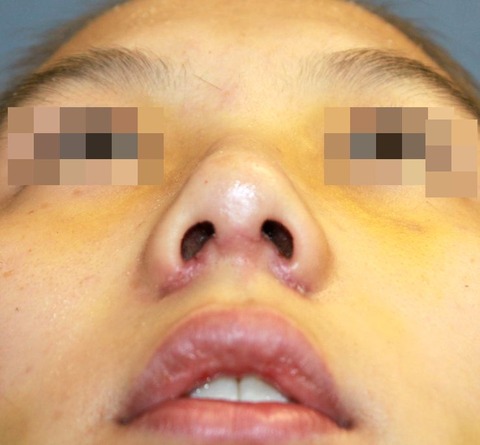 20160908po1Wあおり