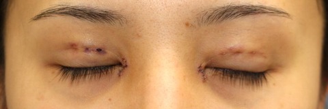 20170608po3d目元閉眼