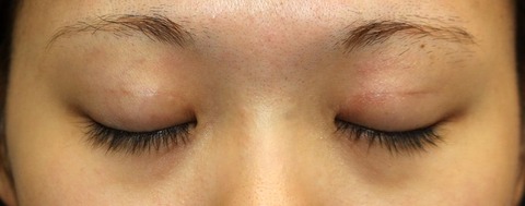 20170202po1M目元閉眼