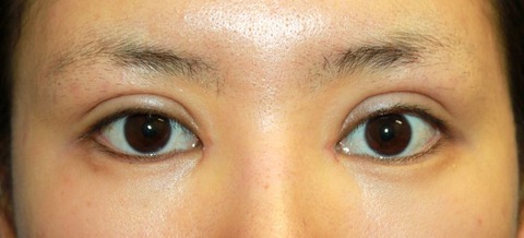 20160829po2W目もと