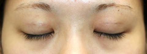 20170107po1W目元閉眼