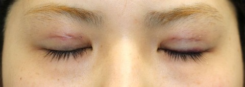 20170427po1d目元閉眼