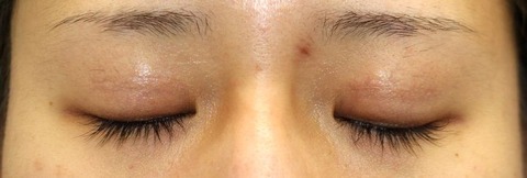 20170506po3M目元閉眼