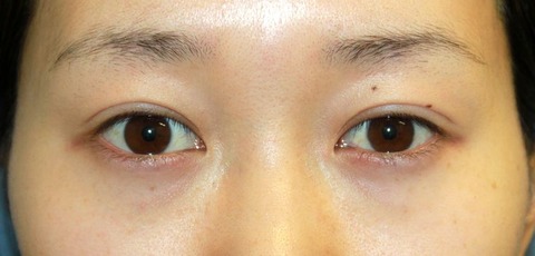 20160929po2M目もと