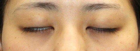 20170311po2M目元閉眼