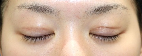 20170506po2M目元閉眼