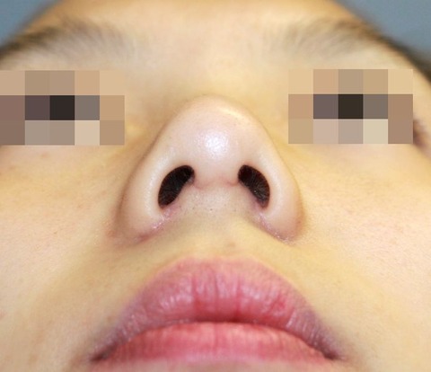 20161112po2Mあおり