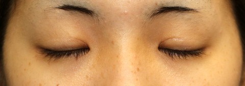 20170311po6M目元閉眼