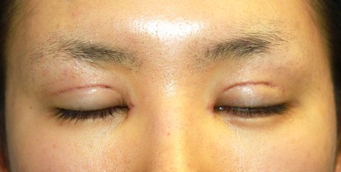 20160829po1W目もと閉瞼