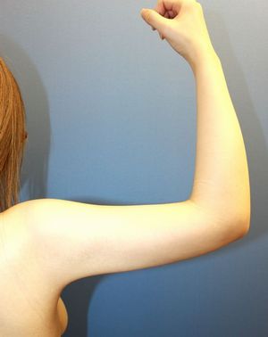 20160906po1M右腕後面