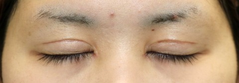 20170328po1M目元閉眼