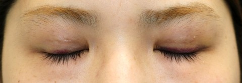 20170506po1W目元閉眼