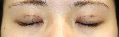 20161121po3d目元閉眼