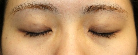 20170414po2M目元閉眼