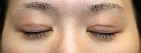 20170608po3M目元閉眼