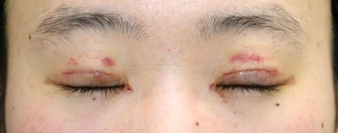 20170311po1W目元閉眼