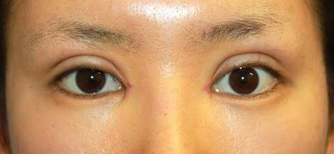 2016829po1W目もと