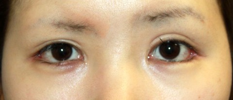 20160913po2W目もと